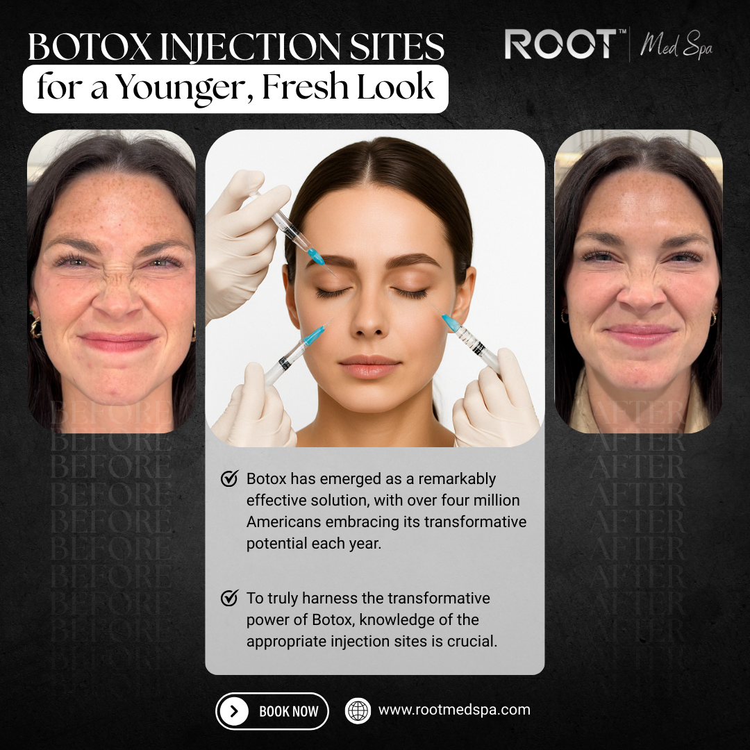 Botox in Flower Mound, TX