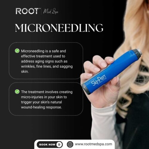 Microneedling in Highland Village/Coppell, TX