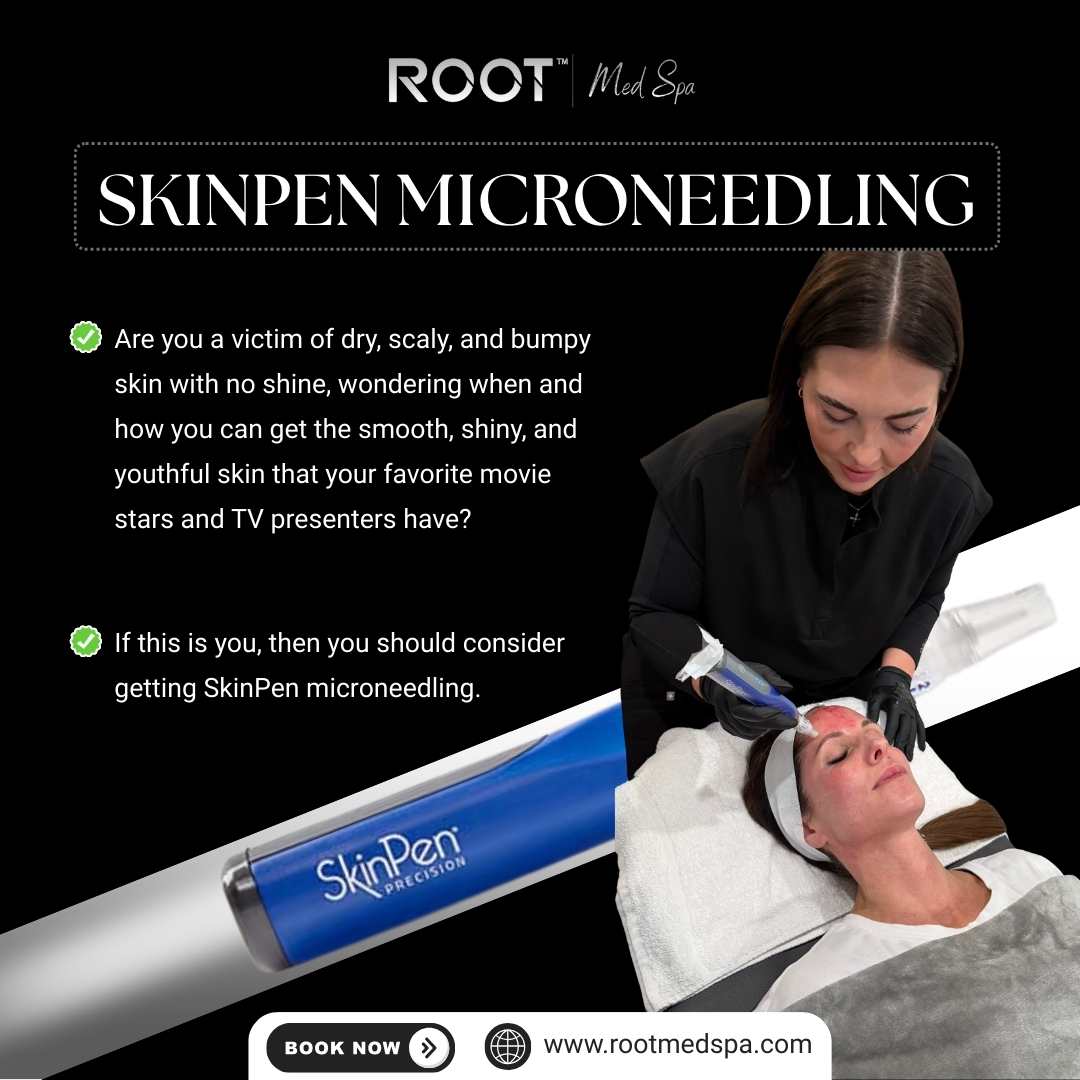 SkinPen Microneedling in Lewisville/Coppell, TX