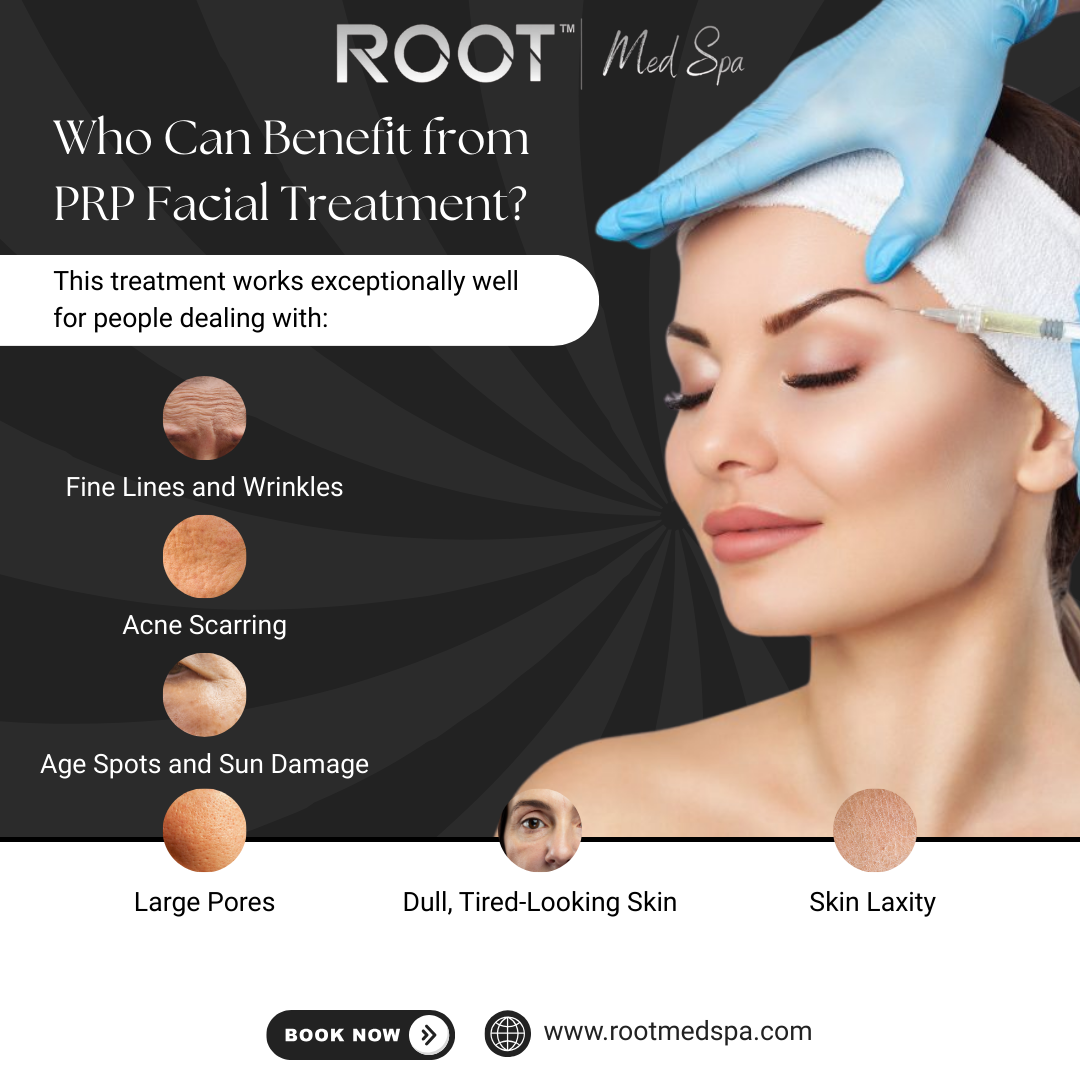 Who Can Benefit from PRP Facial Treatment?