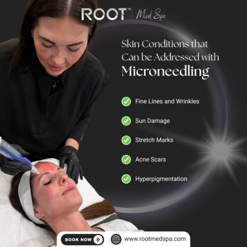 Skin Conditions that Can be Addressed with Microneedling in Flower Mound/Lewisville, TX