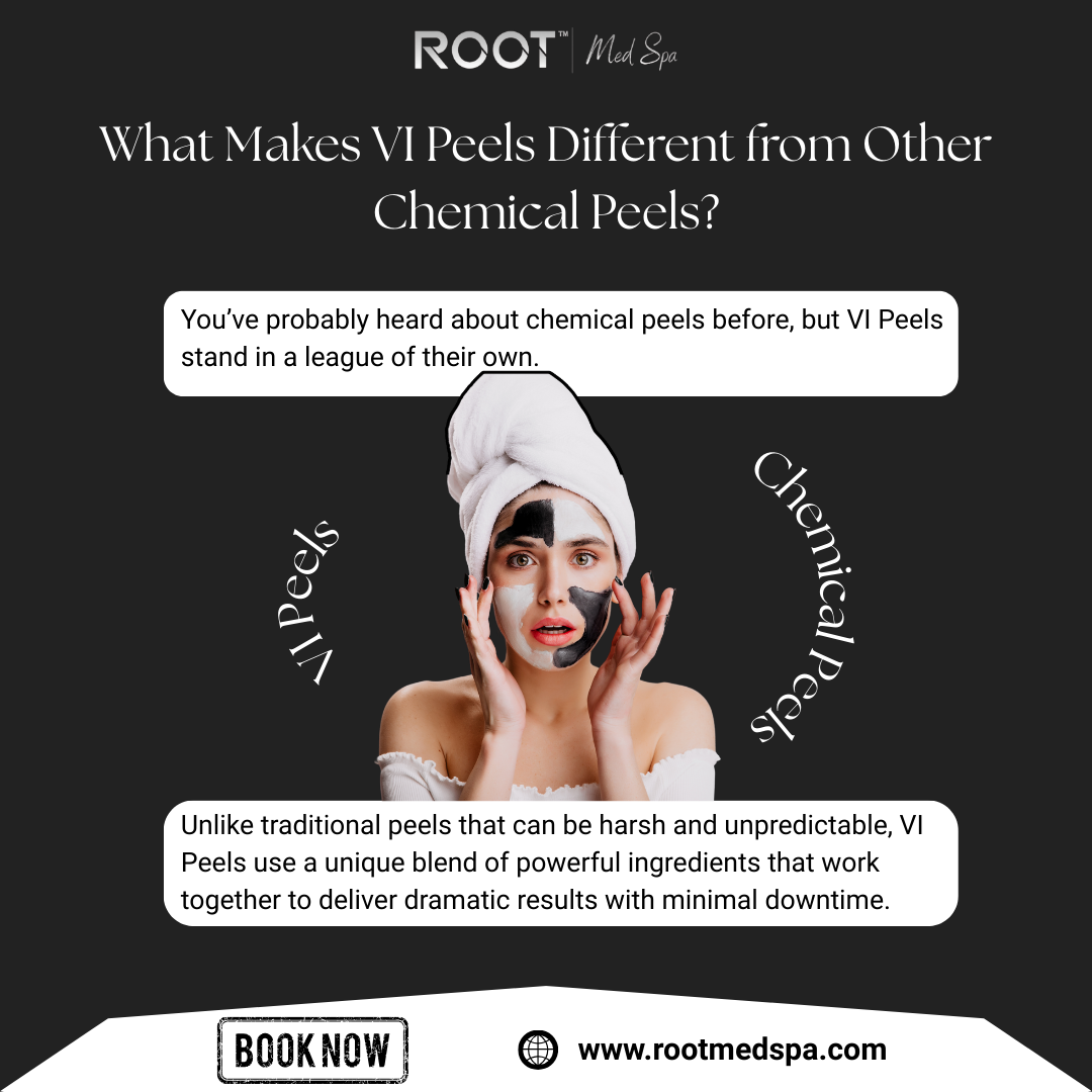 What Makes VI Peels Different from Other Chemical Peels?