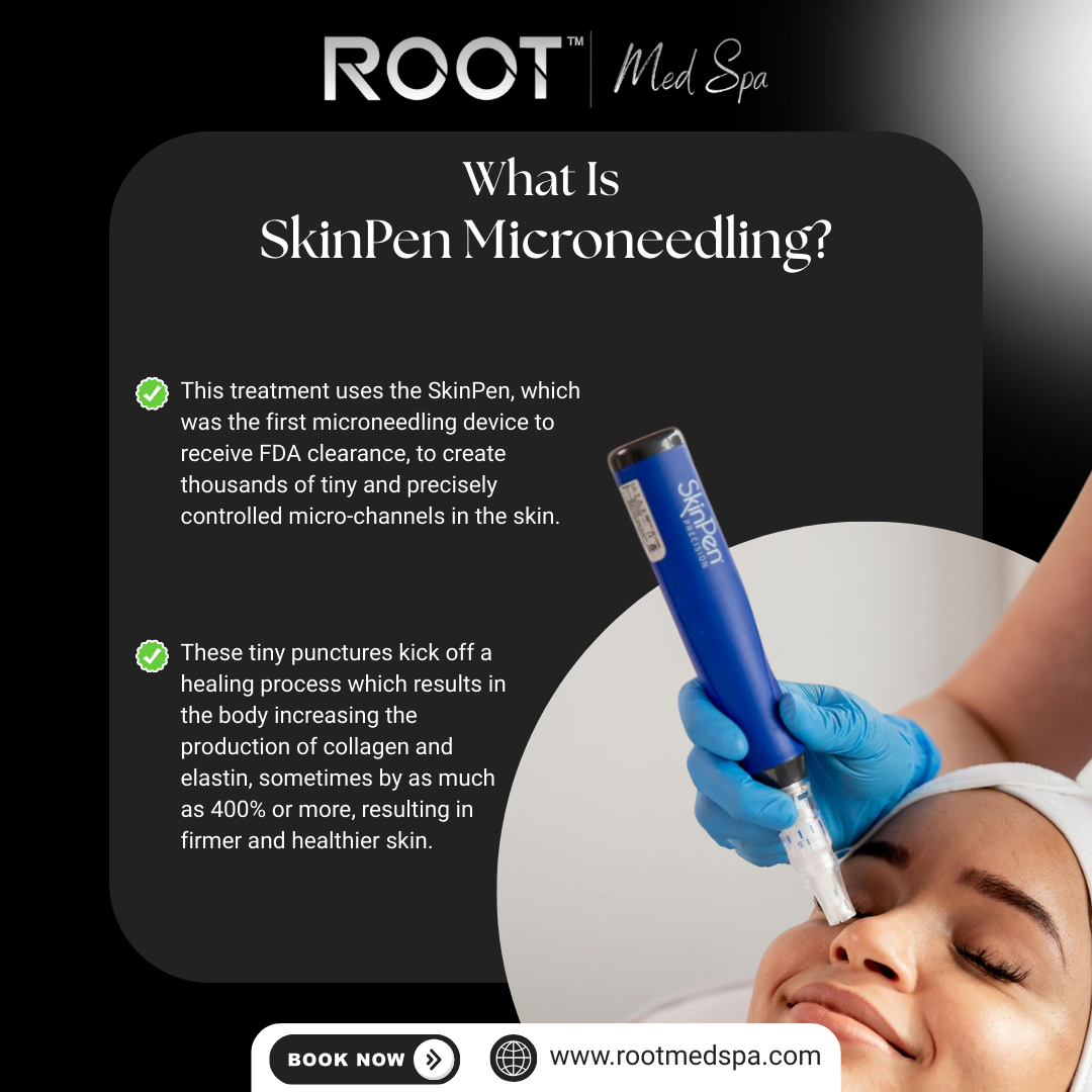 What Is SkinPen Microneedling?