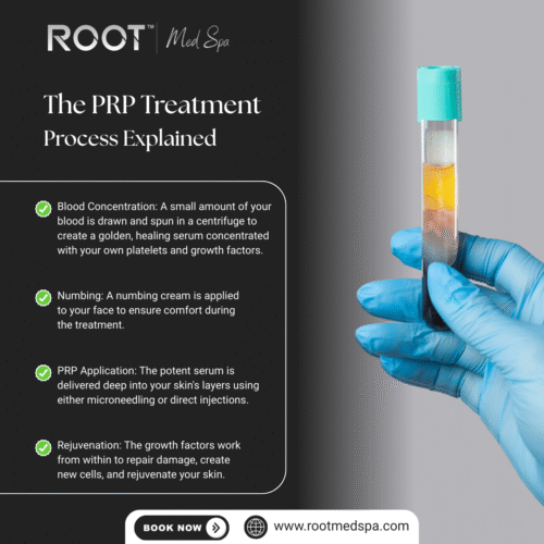The PRP Treatment Process Explained