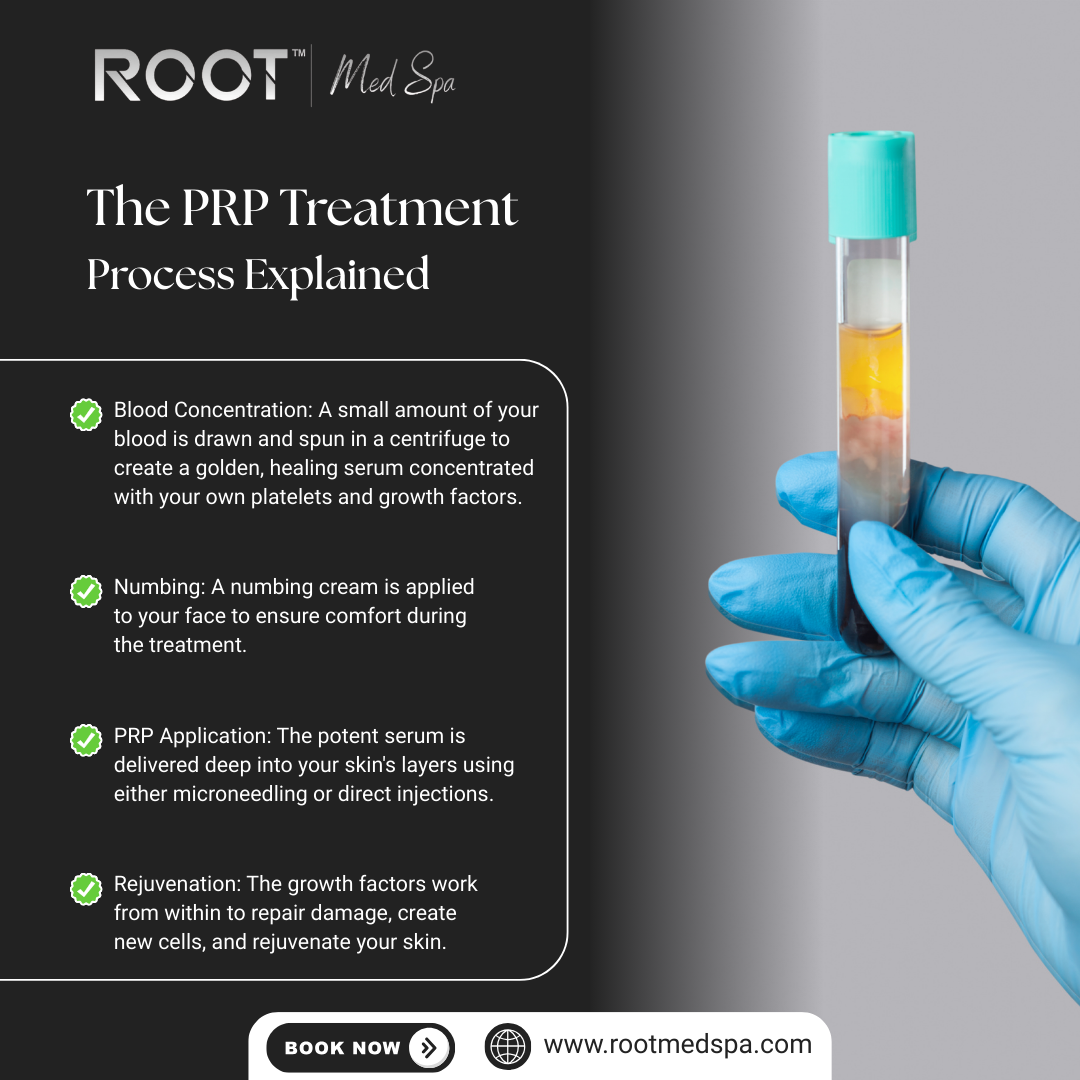 The PRP Treatment Process Explained
