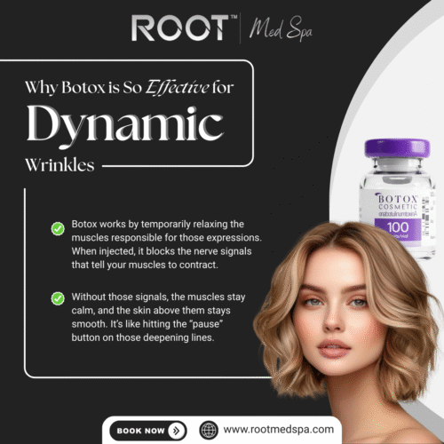 Why Botox is So Effective for Dynamic Wrinkles