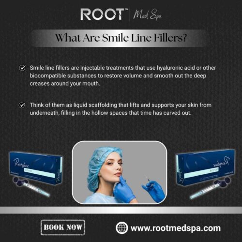 What Are Smile Line Fillers?