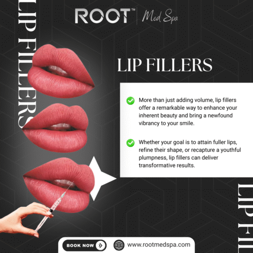 Lip Fillers in Flower Mound, TX