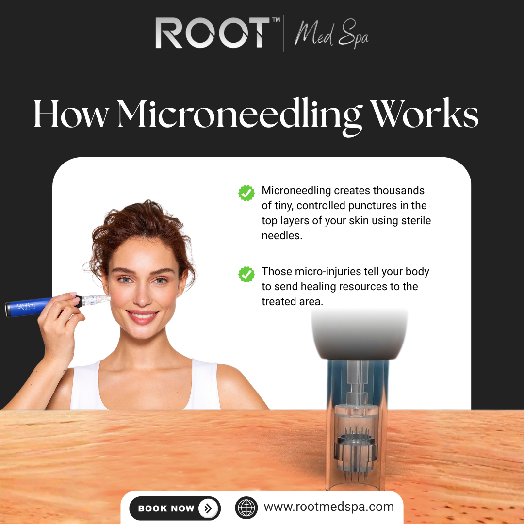 How Microneedling Works