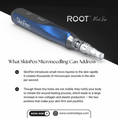 What SkinPen Microneedling Can Address