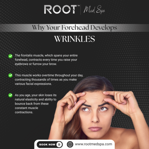 Why Your Forehead Develops Wrinkles