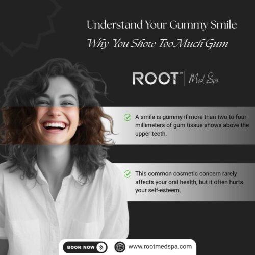 Understand Your Gummy Smile: Why You Show Too Much Gum
