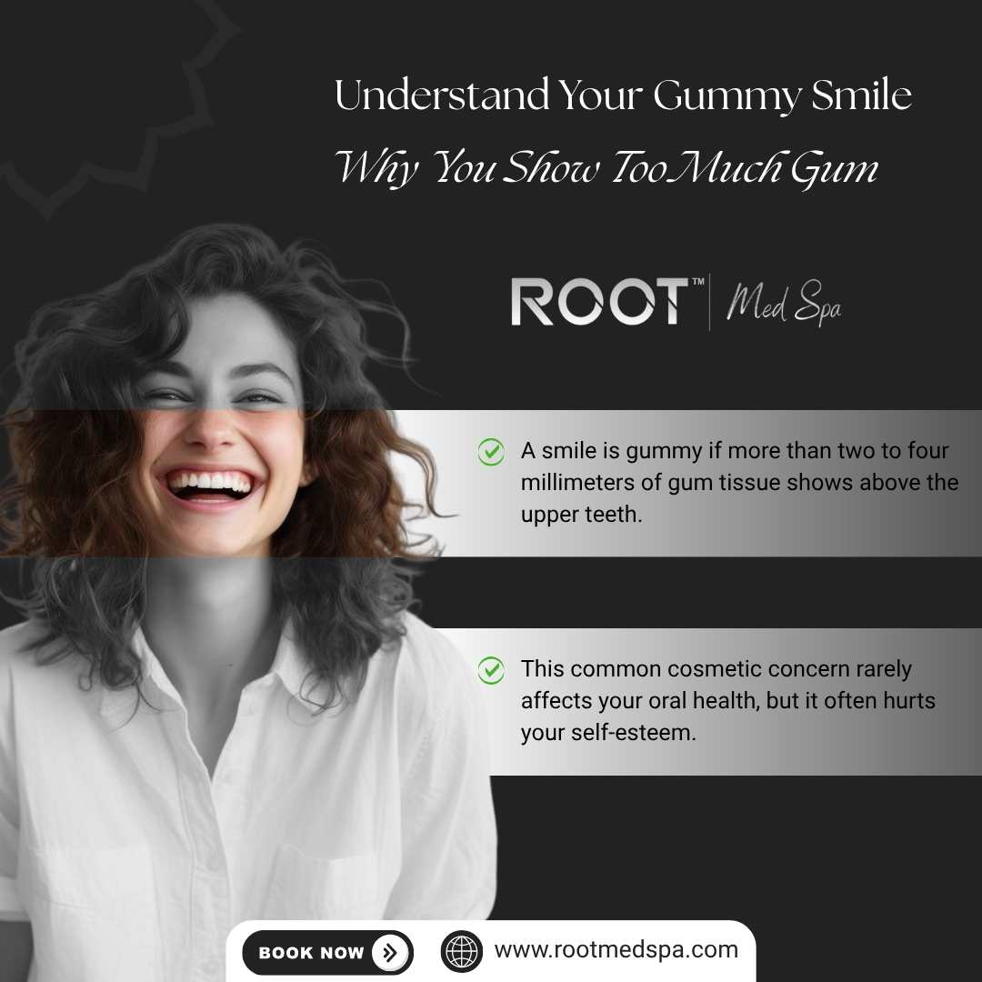 Understand Your Gummy Smile: Why You Show Too Much Gum