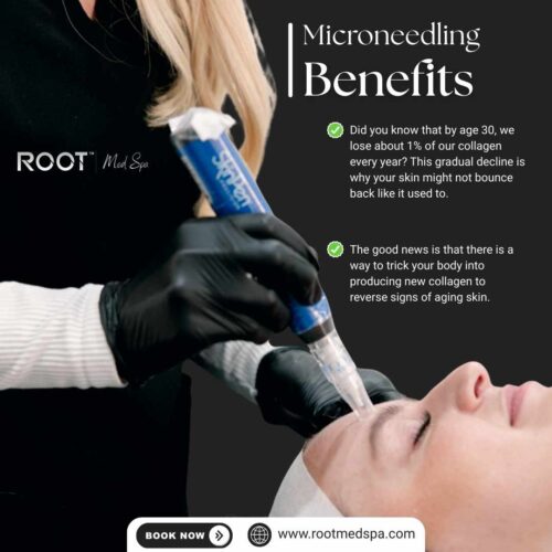 Microneedling Benefits in Flower Mound/Dallas, TX
