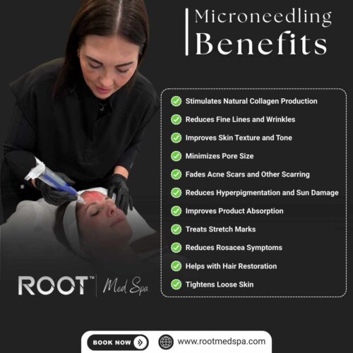 15 Powerful Microneedling Benefits for Your Skin