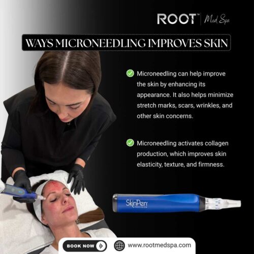 Ways Microneedling Improves Skin