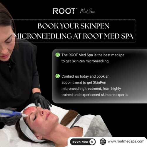 Book Your SkinPen Microneedling at ROOT Med Spa