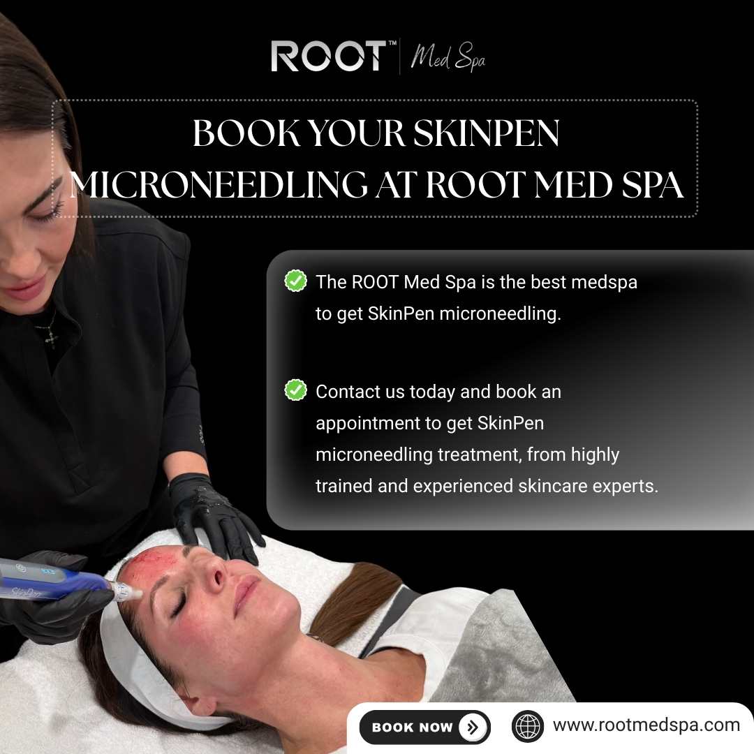 Book Your SkinPen Microneedling at ROOT Med Spa