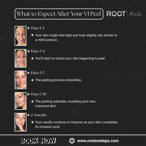 What to Expect After Your VI Peel