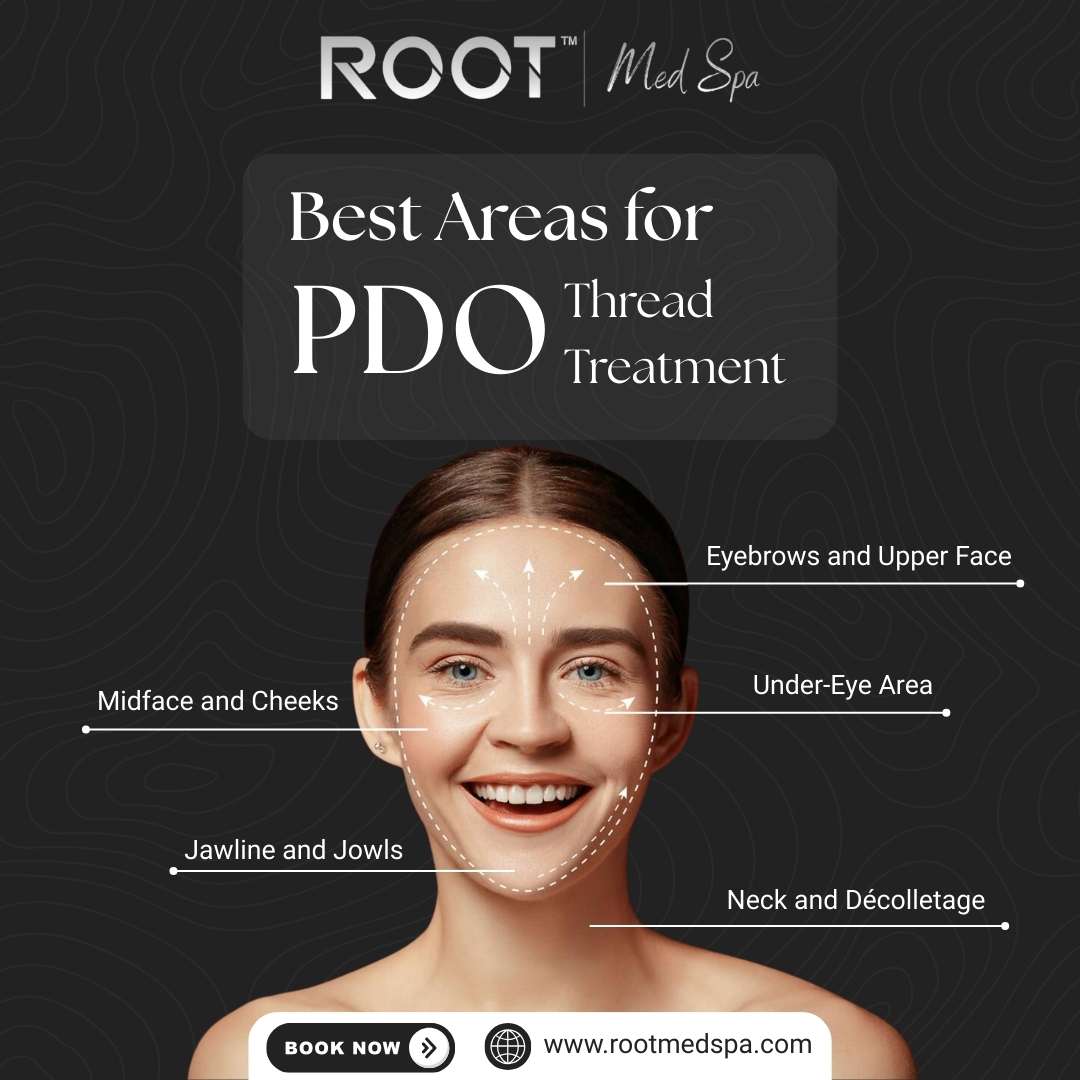 Best Areas for PDO Thread Lift