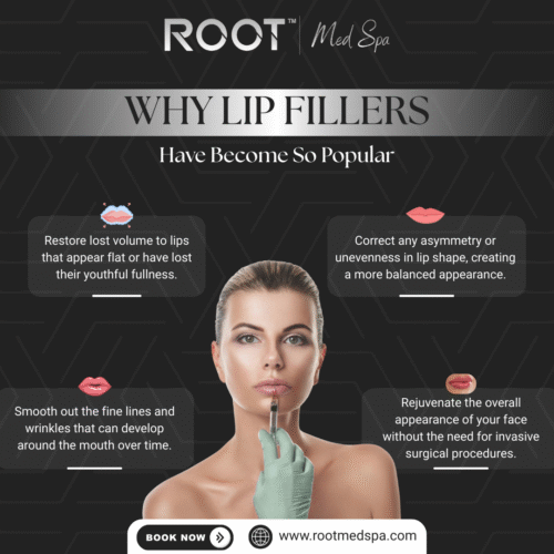 Why Lip Fillers Have Become So Popular