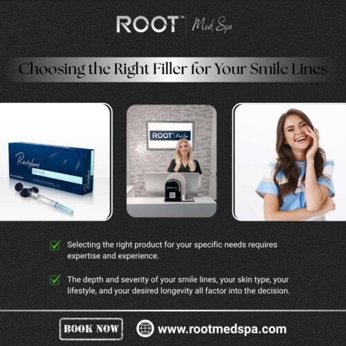Choosing the Right Filler for Your Smile Lines
