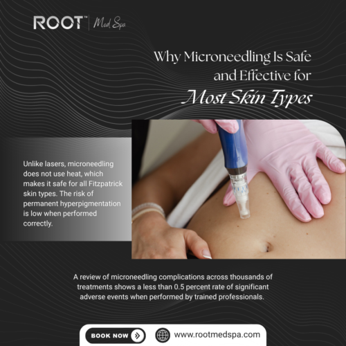 Why Microneedling Is Safe and Effective for Most Skin Types
