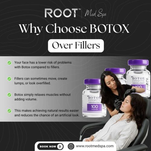 Why Choose Botox Over Fillers