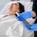 SkinPen Microneedling Before and After