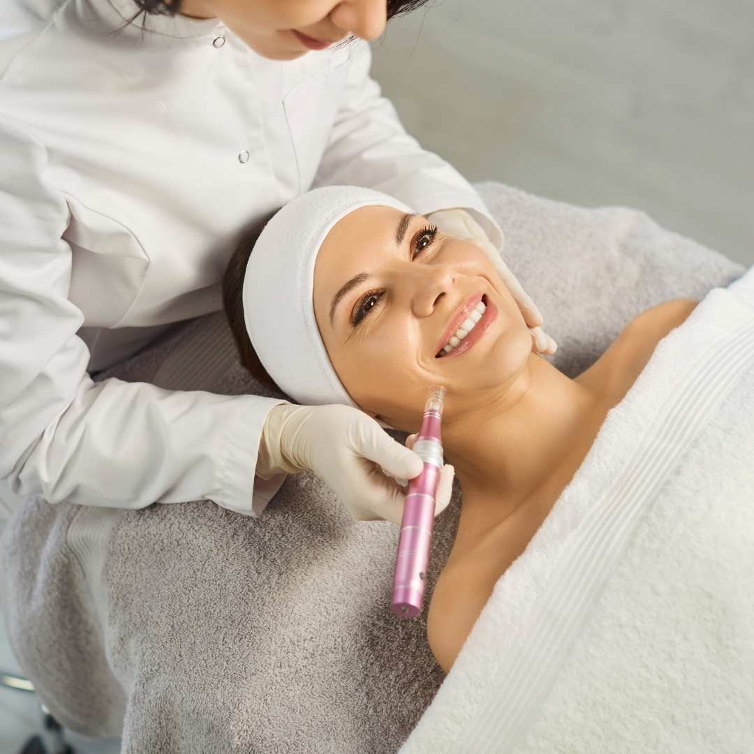 Microneedling Before & After Results in Flower Mound/Coppell, TX