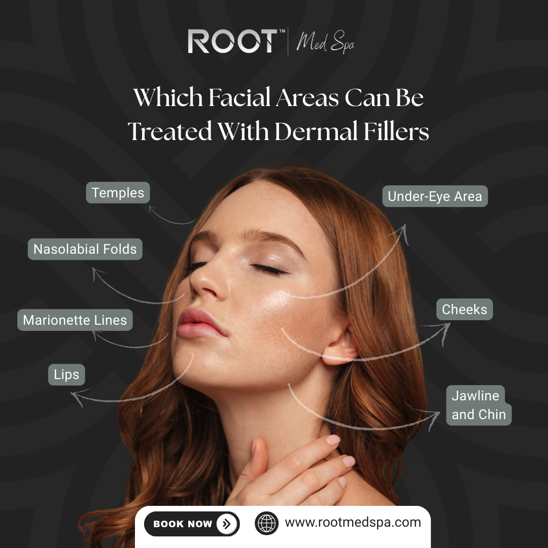 Which Facial Areas Can Be Treated With Dermal Fillers in Flower Mound, TX? 