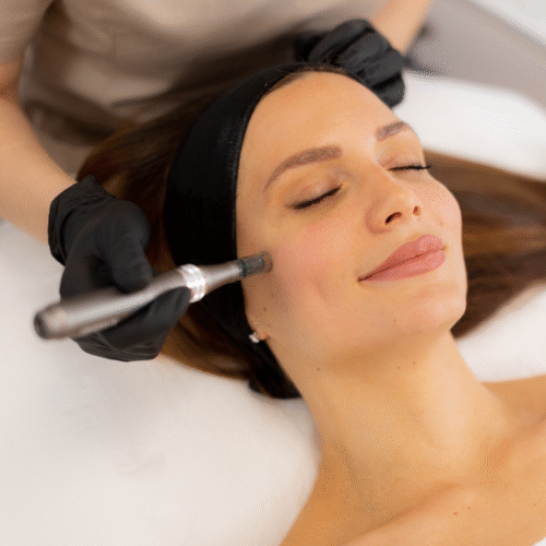 Microneedling Cost | Affordable Option