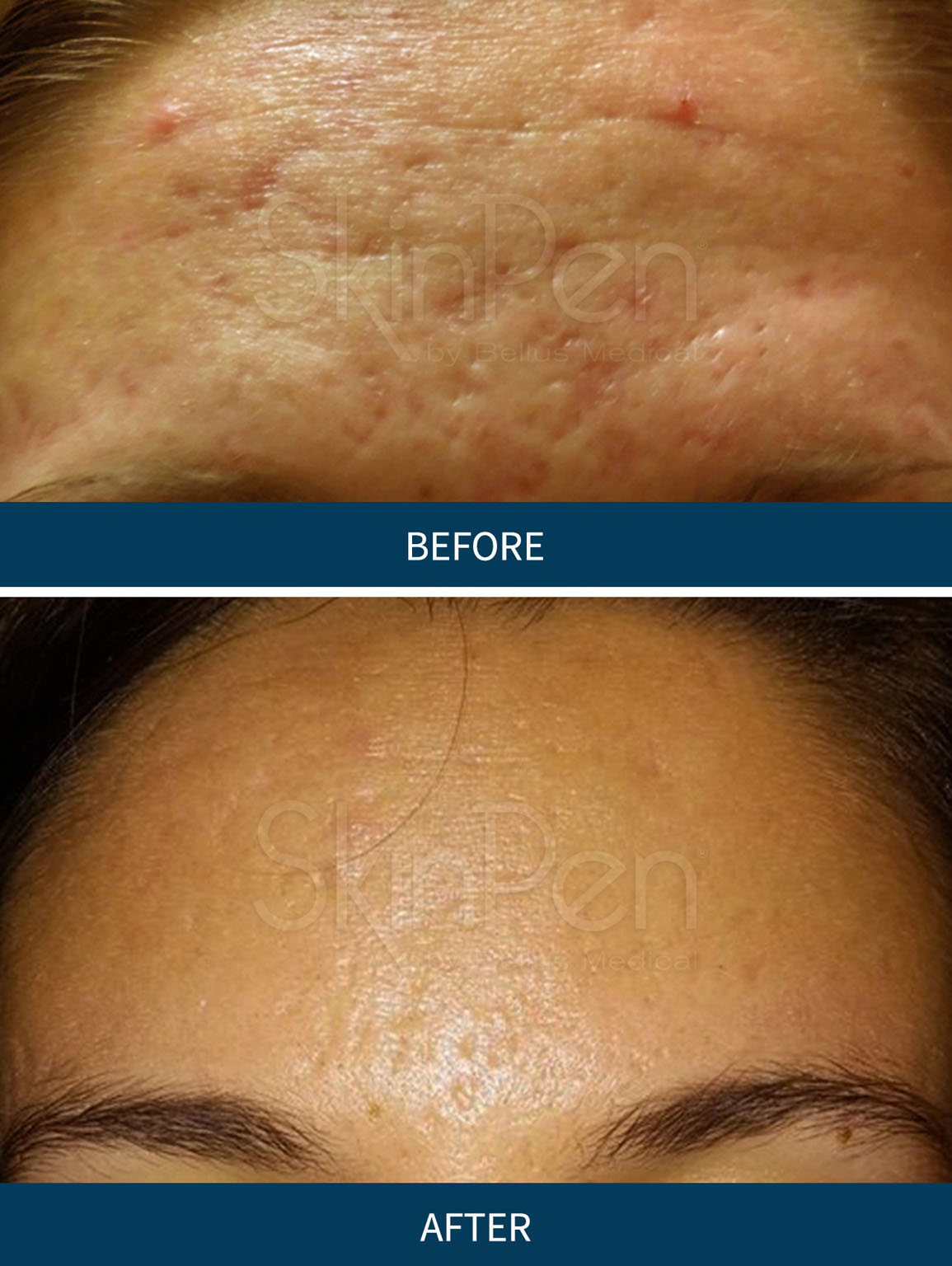 Before-and-After-Picture-CA-6b