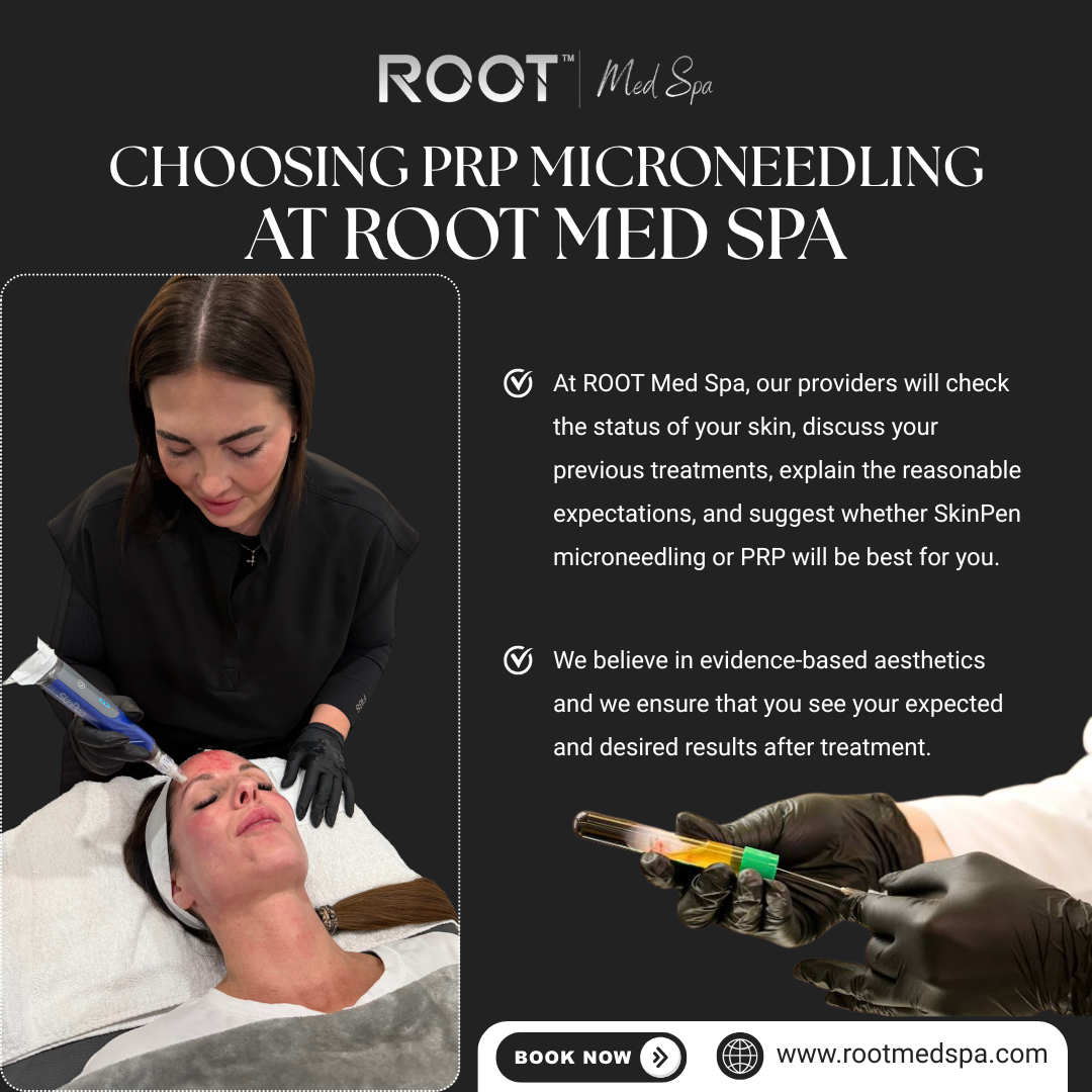 Choosing PRP Microneedling in Flower Mound / Coppell, TX at ROOT Med Spa
