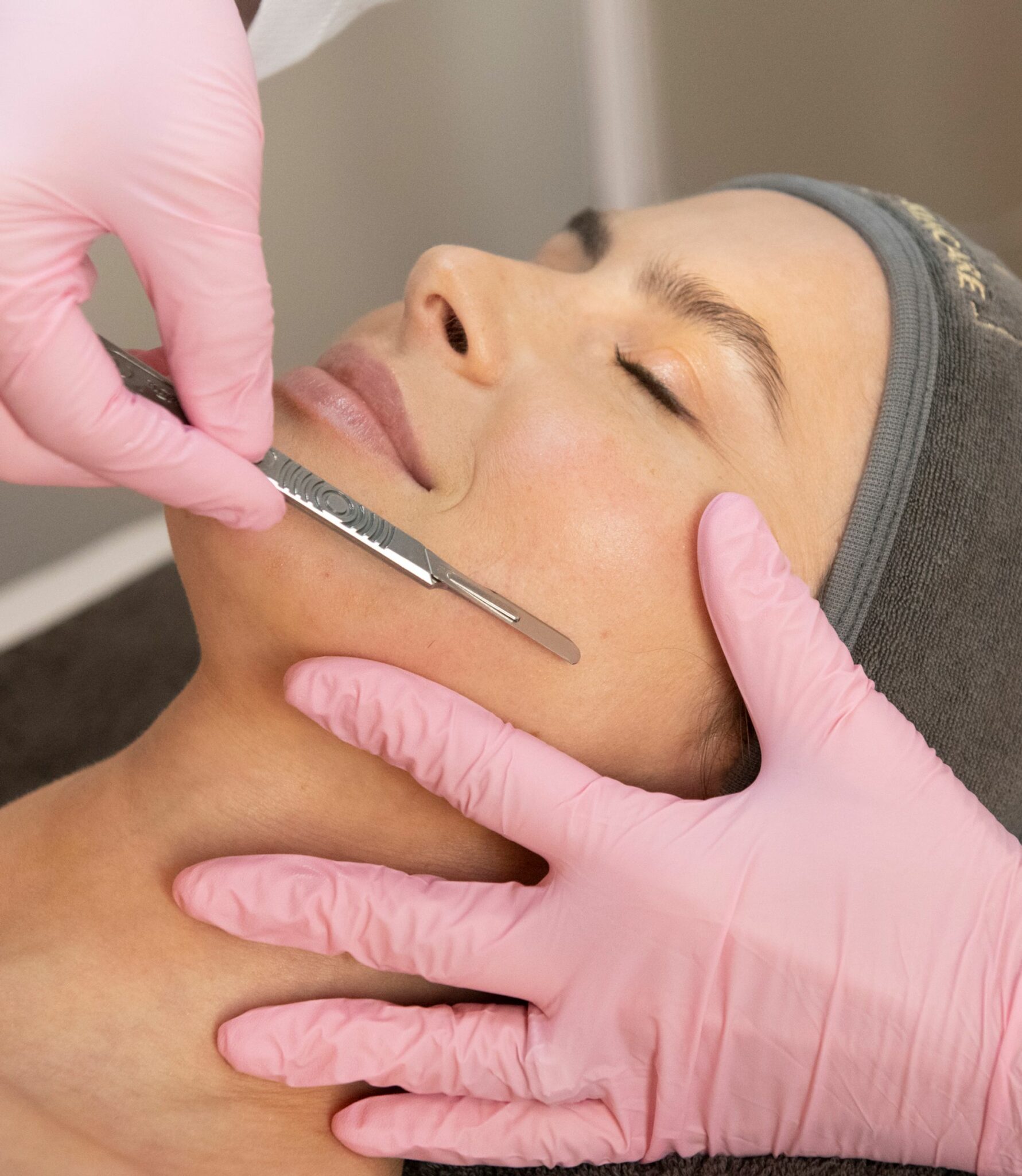 Dermaplaning-image--1781x2048