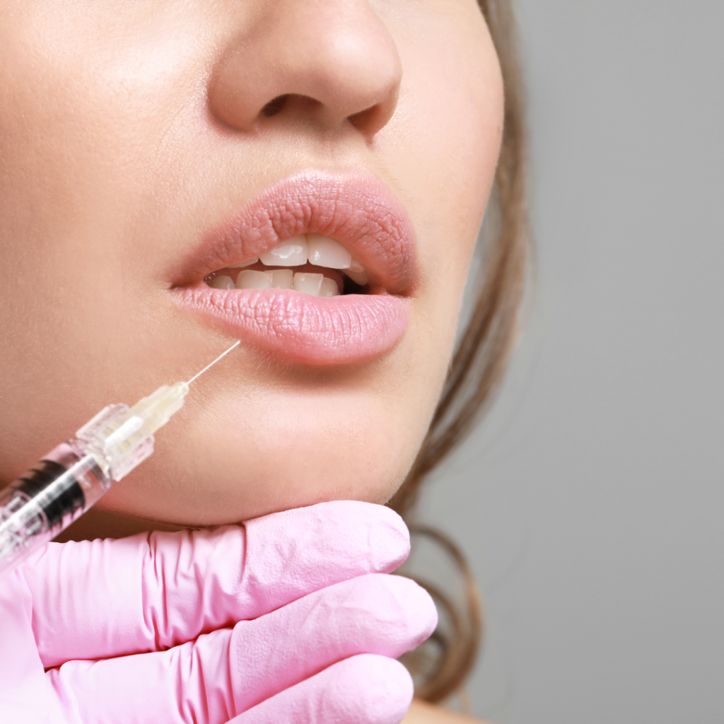 Lip Filler Migration in Flower Mound/Coppell, TX: Signs to Watch