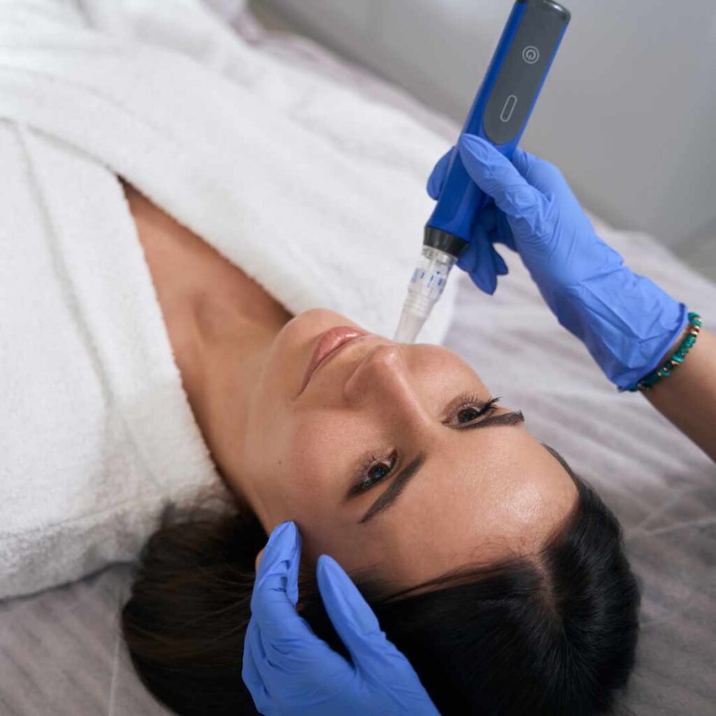 SkinPen Before and After in Flower Mound/Coppell, TX | Real Results