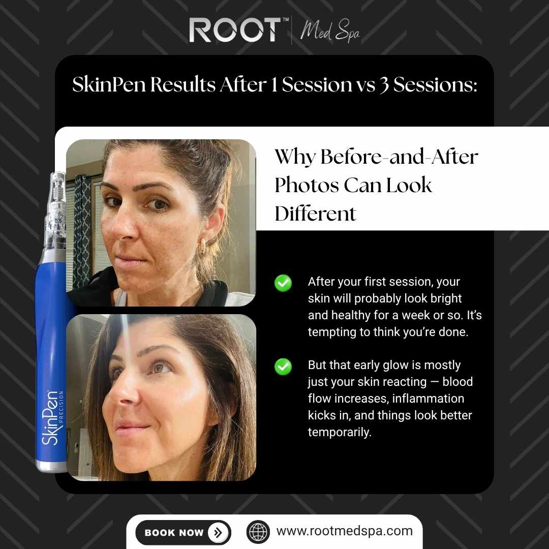 Why Before-and-After Photos Can Look Different