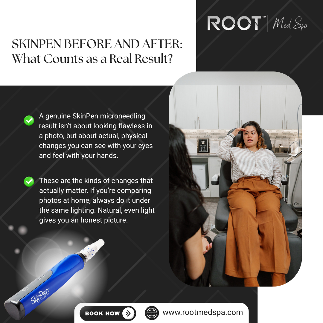 SkinPen Before and After in Flower Mound, TX: What Counts as a Real Result?