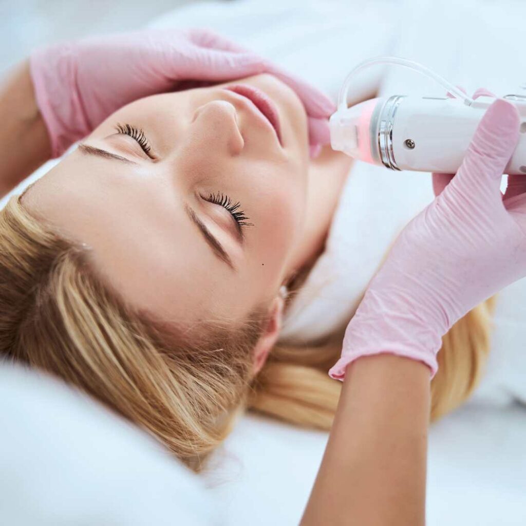 Microneedling Flower Mound, TX
