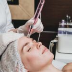 SkinPen Microneedling in Flower Mound, TX