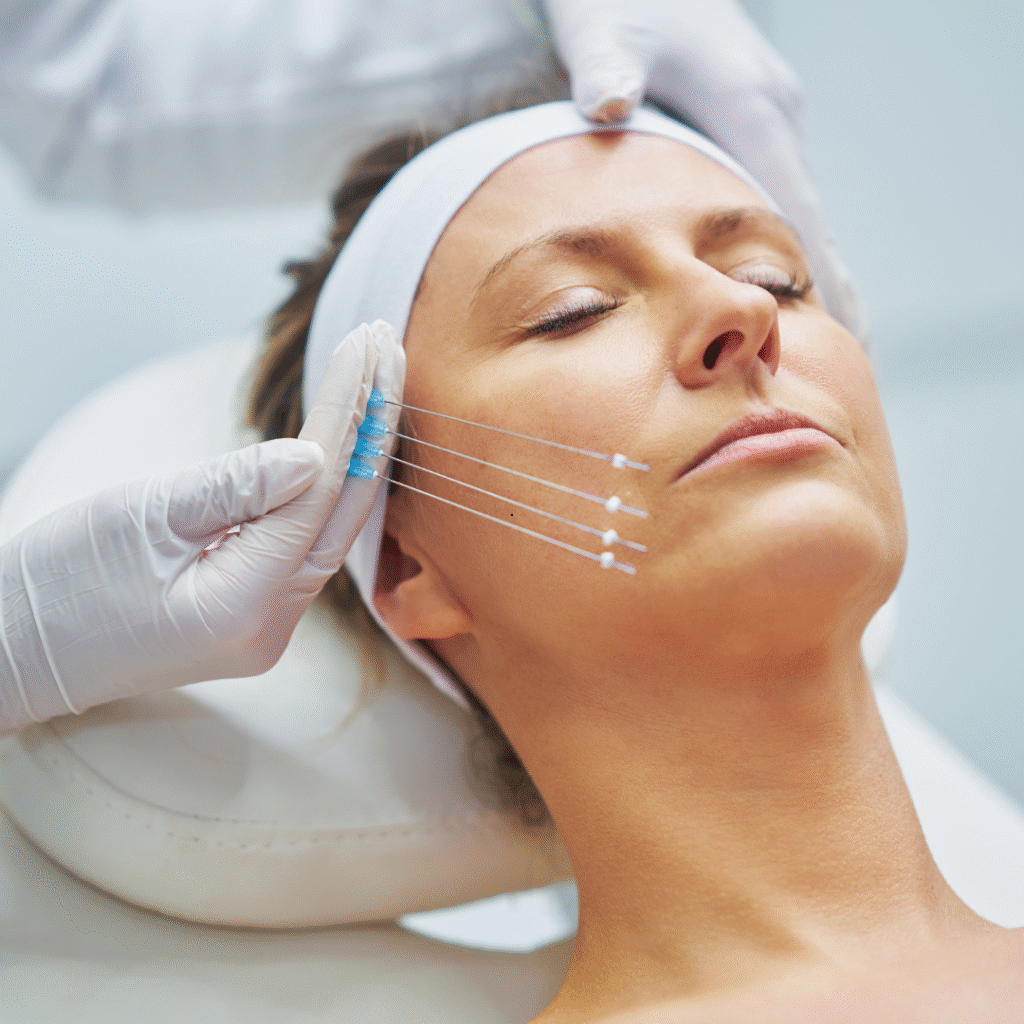 PDO Thread Lift for Neck, Jaw & Wrinkles