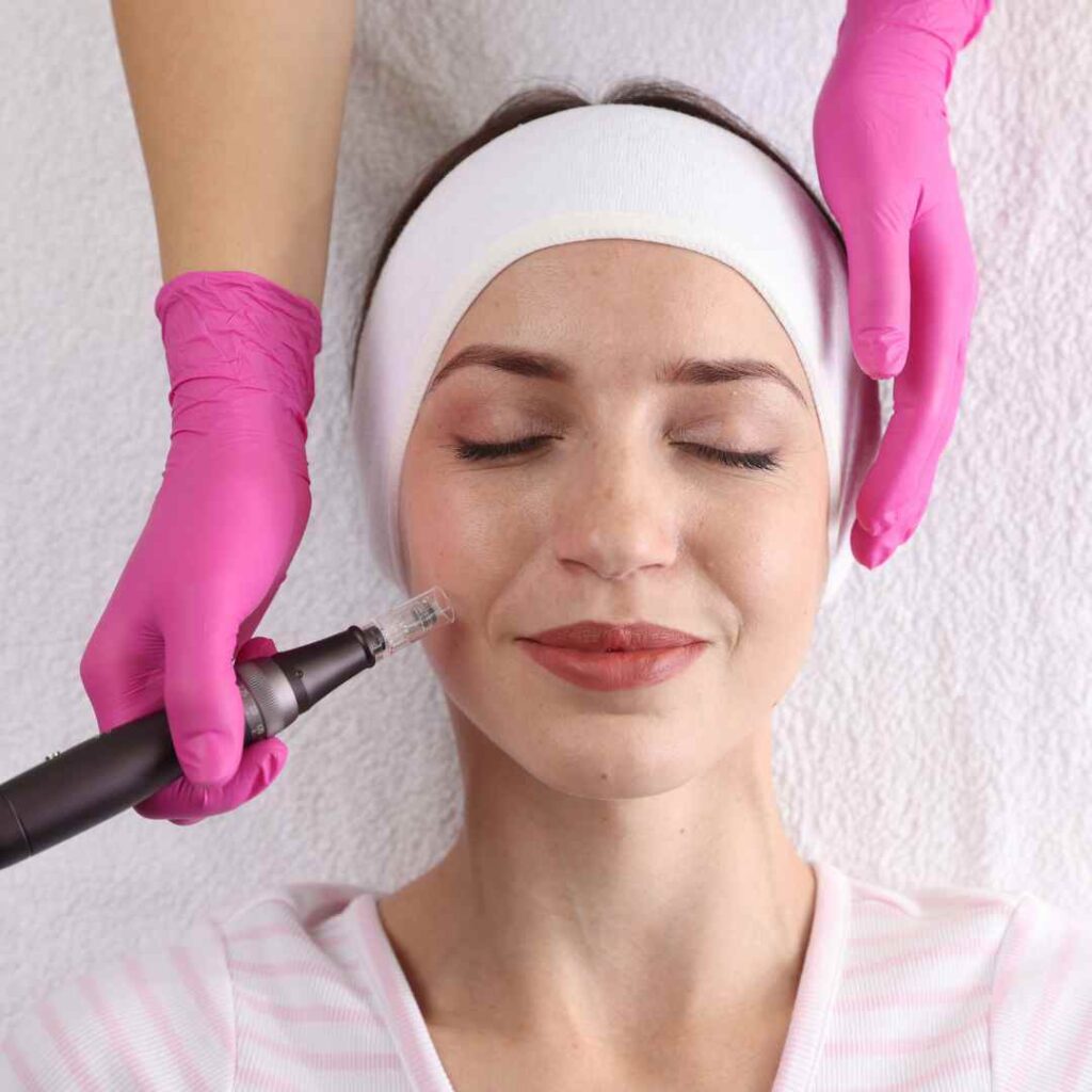 Microneedling + Peels/Fillers in Flower Mound/Coppell, TX