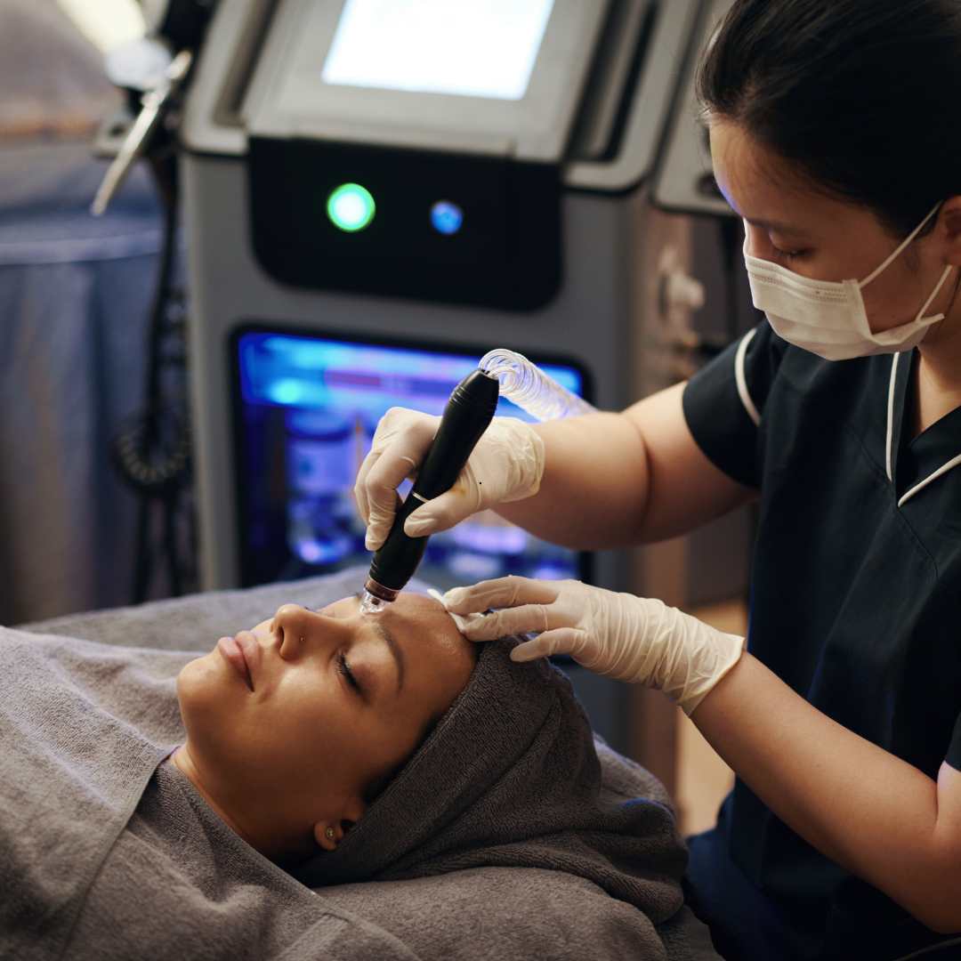 Microneedling Benefits