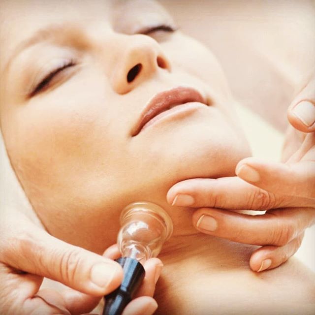 facial-cupping-image